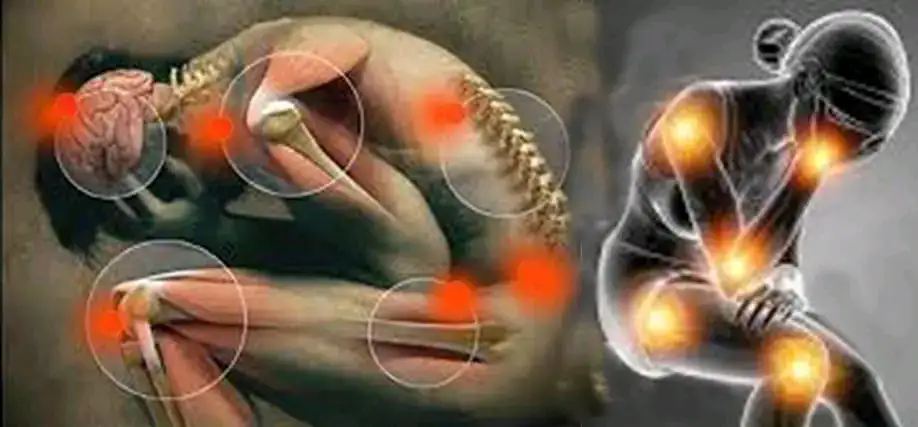 Terapia Neural  2