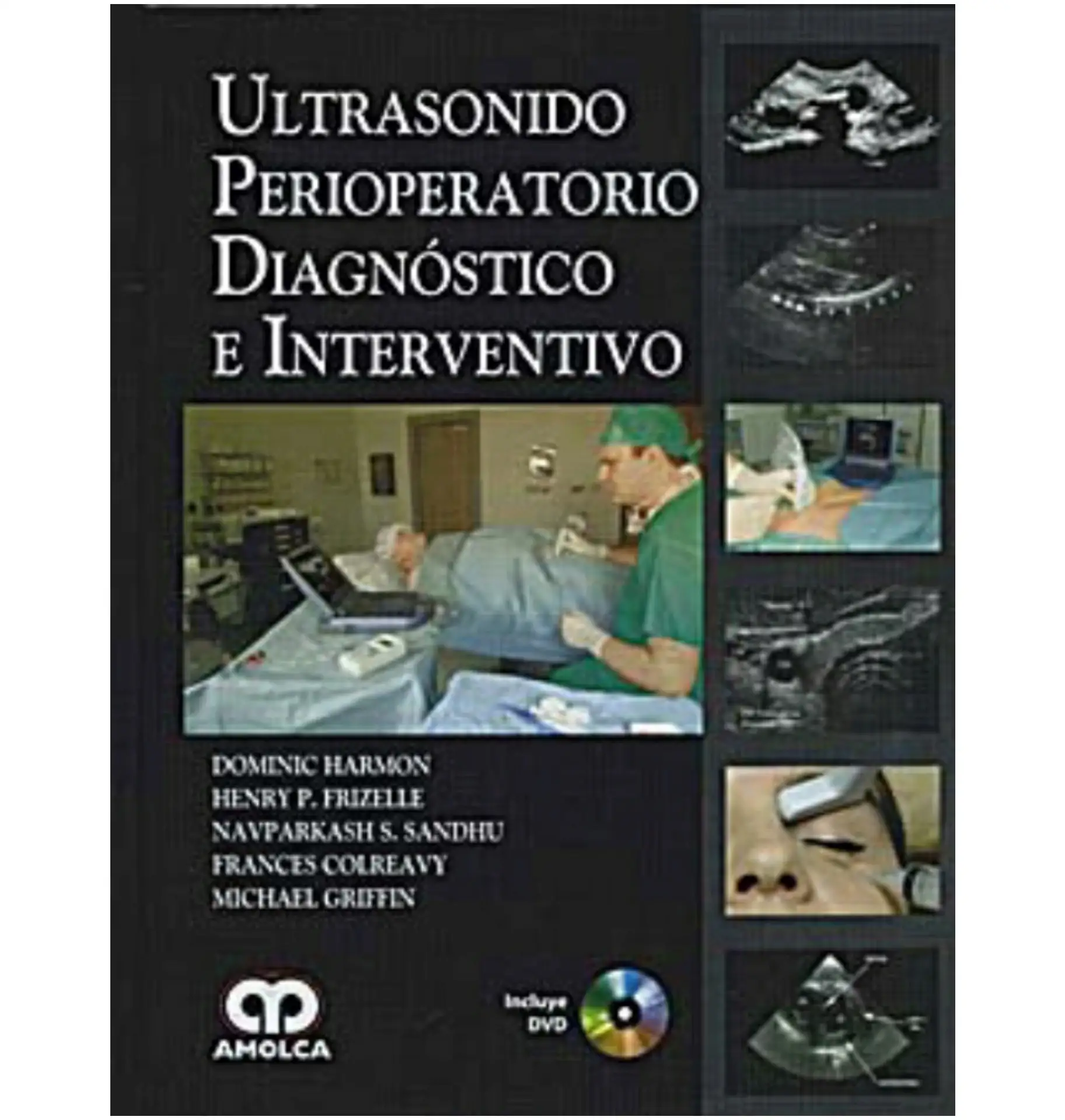 Ultrasonido perioperatorio.