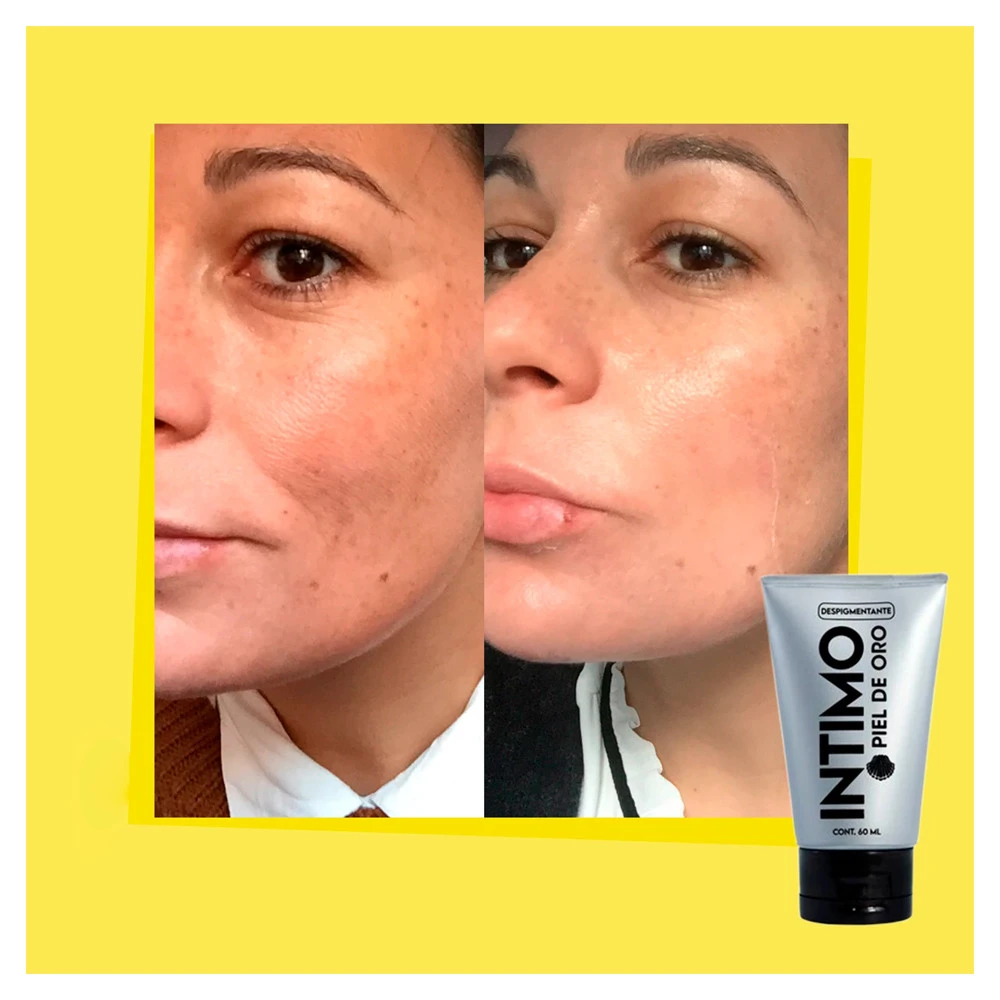 Despigmentante aclarante intimo 60ml 4