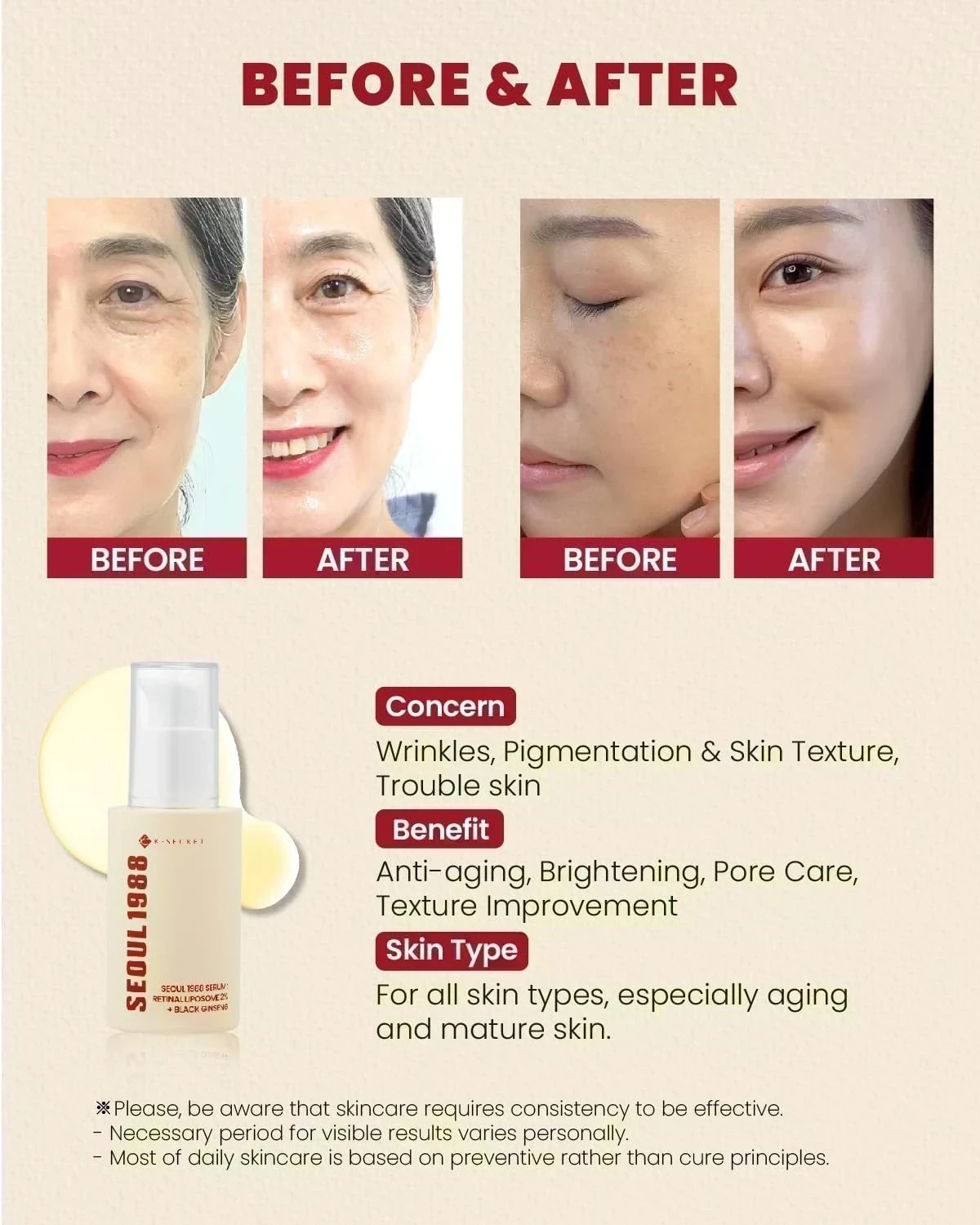 KSECRET - SEOUL 1988 Serum : Retinal Liposome 2% + Black Ginseng [30ml] 3
