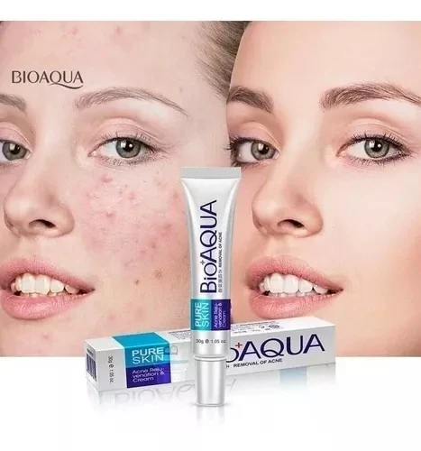 Crema para el acné bioaqua 🤗🌺💕 2