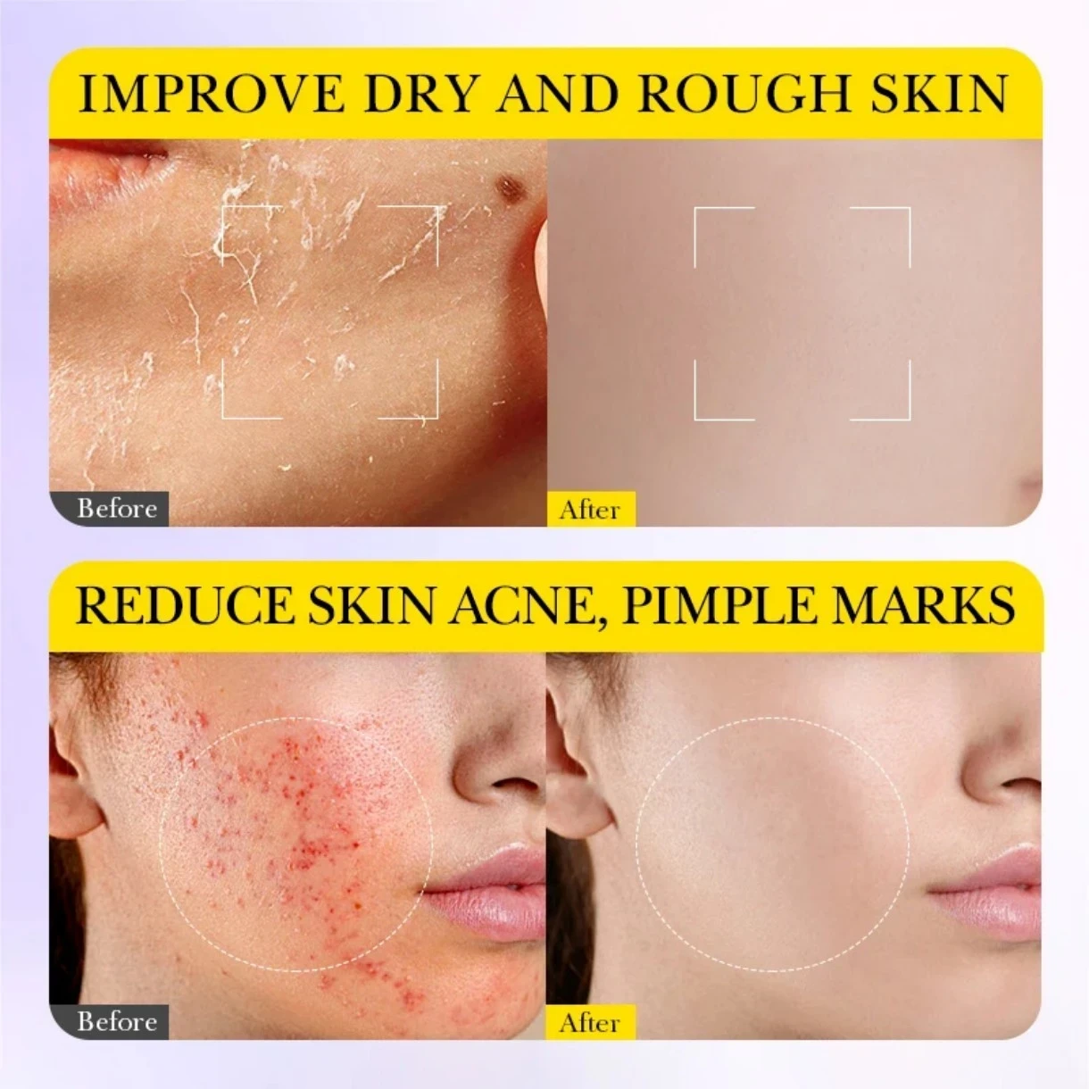 ✨ Mascarilla Facial Ampoule Triple Ácido Salicílico – Sadoer ✨ ☺️ 3