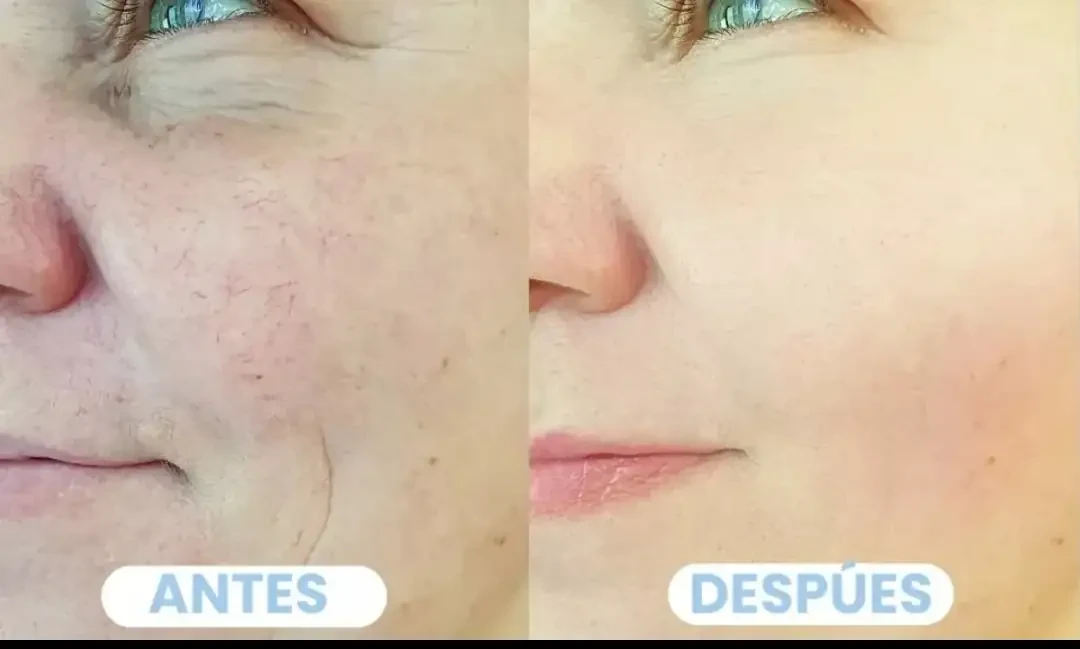 NAD+ Resveratrol 1500MG - antienvejecimiento  4