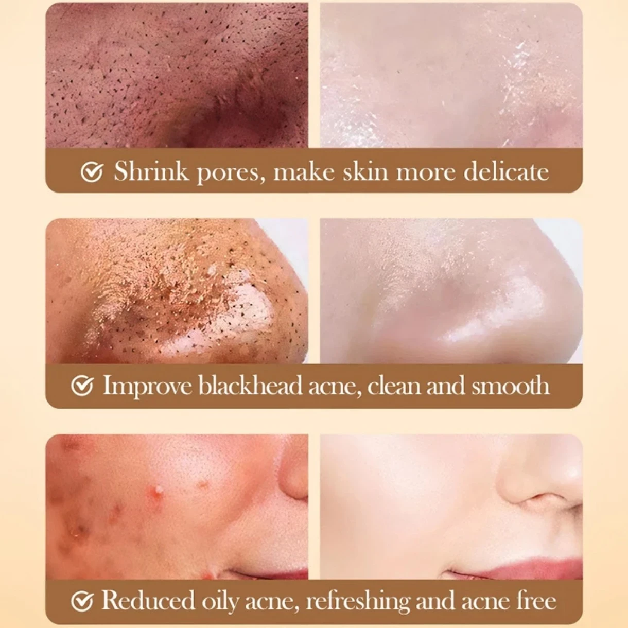 ✨ Kit de Arroz BIOAQUA – Luminosidad, Hidratación y Piel de Porcelana en 6 pasos ☺️💖 5