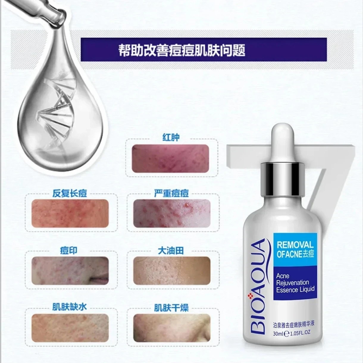 🌿 Bioaqua Acne Rejuvenation Essence — Piel más limpia, calma y renovada ☺️💖30 ml 2