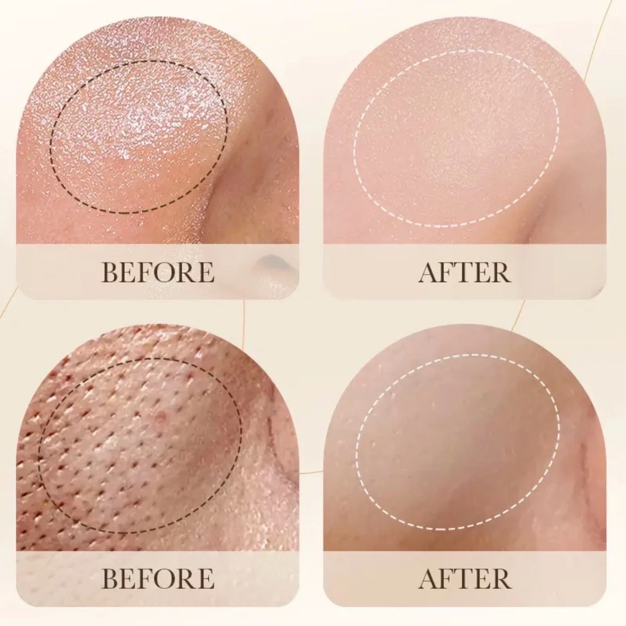 Espuma Limpiadora Facial Bioaqua 2