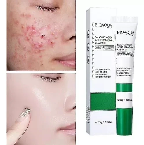 CREMA ANTI-ACNÉ DE ÁCIDO SALICÍLICO BIOAQUA ☺️💖 2