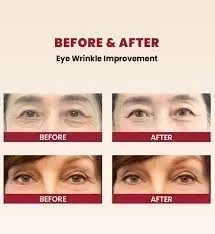 KSECRET - SEOUL 1988 Eye Cream : Retinal Liposome 4% + Fermented Bean [30ml] 2