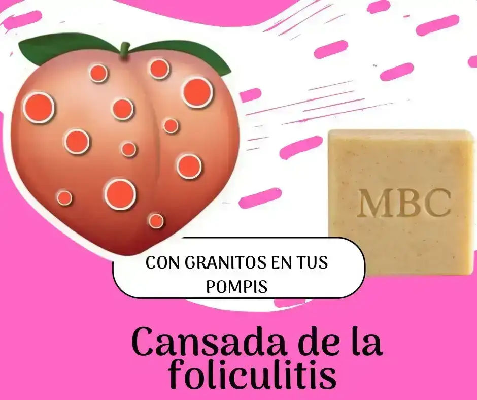 Jabon foliculitis