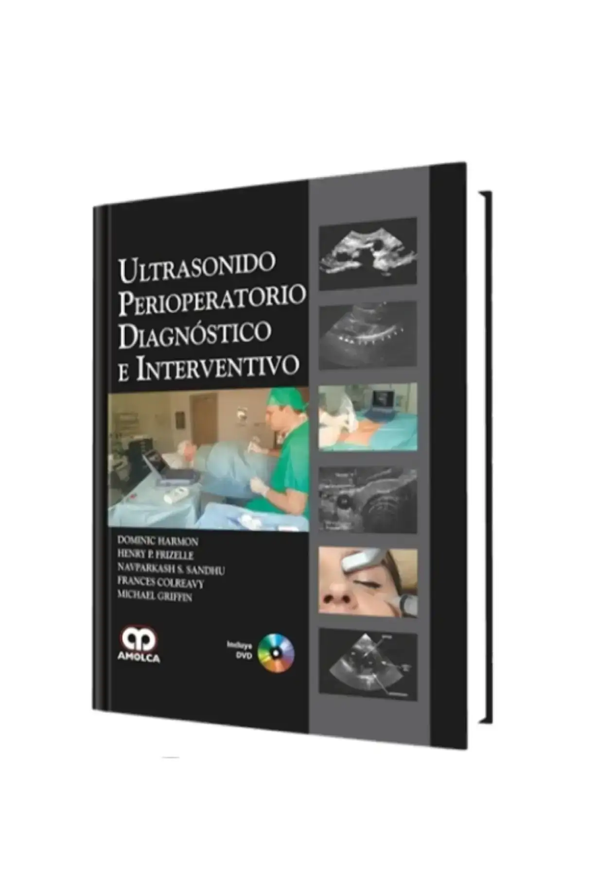 Ultrasonido perioperatorio. Diagnóstico e interventivo 