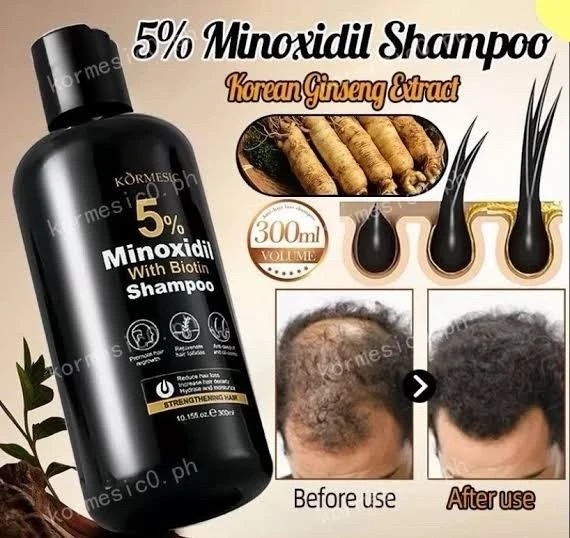 Shampoo con Minoxidil 5% y Biotina Kormesic