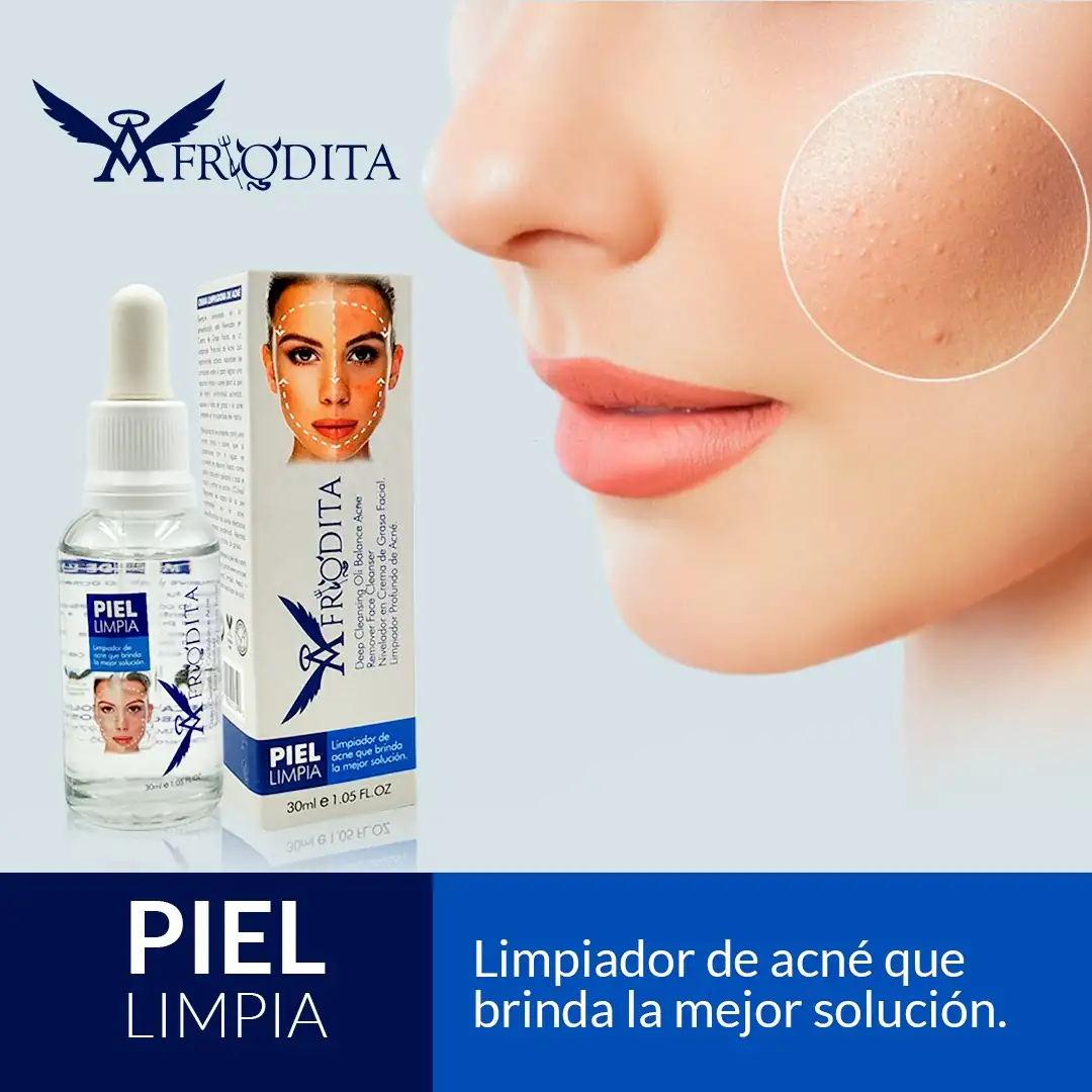 SERUM ANTI ACNE AFRODITA