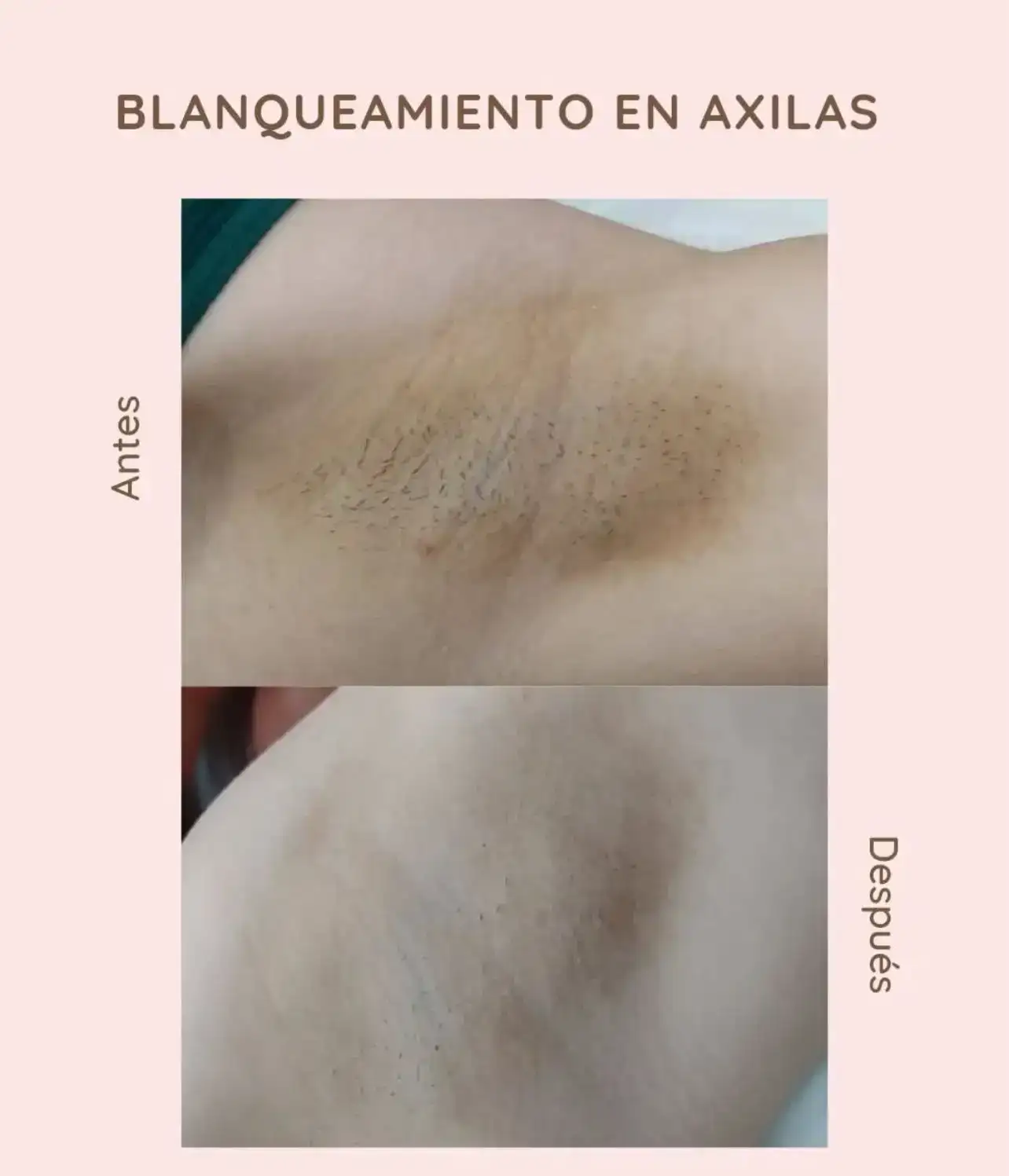 Crema aclaradora  3