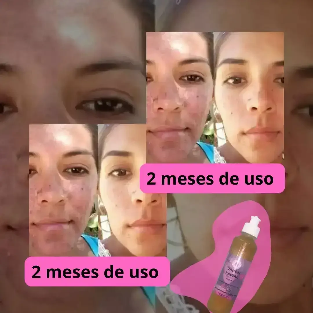 Jabon facial